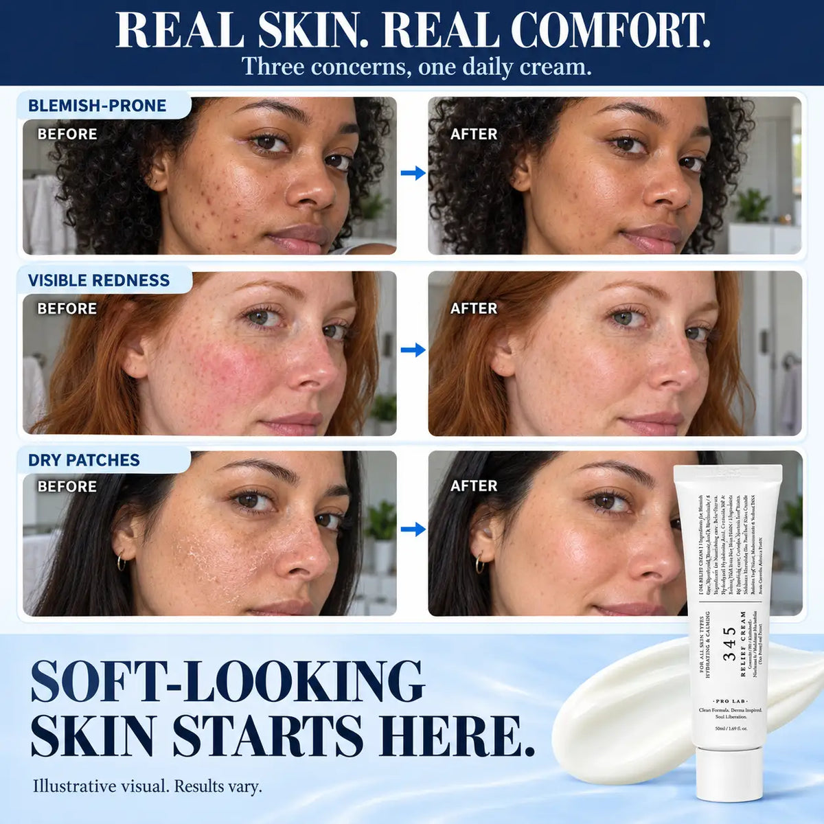 Pawreluna® 🍃Advanced Blemish Relief Cream – Daily Moisture for Breakout-Prone Skin