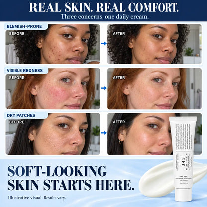 Pawreluna® 🍃Advanced Blemish Relief Cream – Daily Moisture for Breakout-Prone Skin